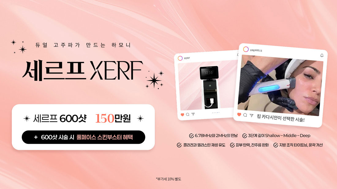 세르프